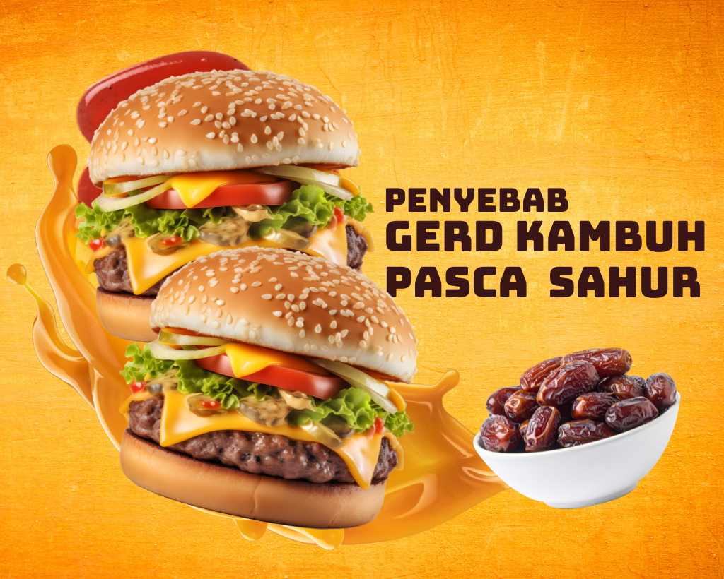Aturan Waktu Tidur Setelah Sahur Supaya GERD Tidak Kambuh
