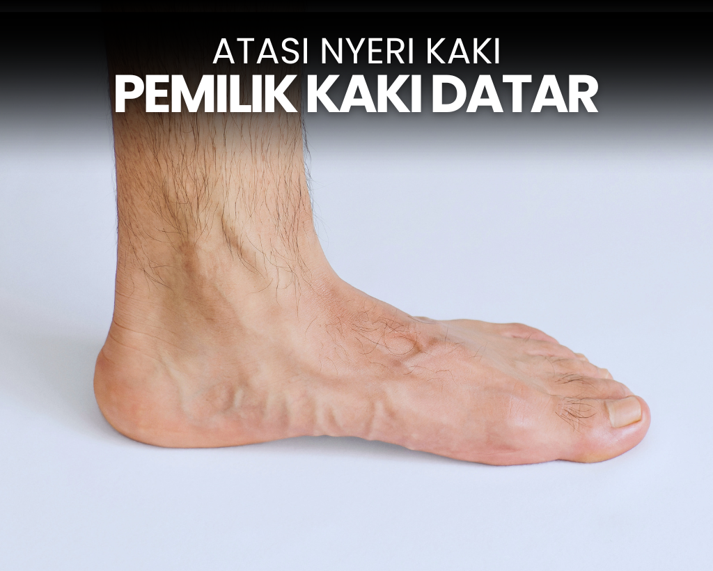 Kaki Nyeri? Ini Saran Dokter bagi Kaki Datar yang Suka Olahraga